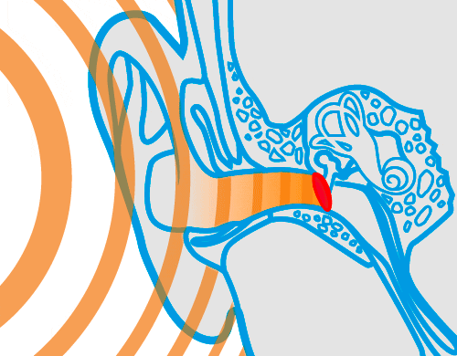 schema_sf_ohne_500x390_ebenen_ani_v1.gif