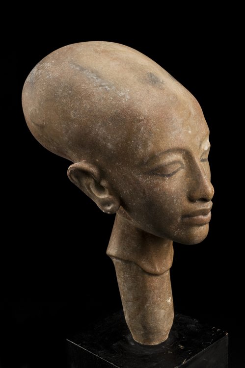 Copy_of_a_statue_showing_a_deformed_cranium,_Cairo,_Egypt,_1_Wellcome_L0058421.jpg